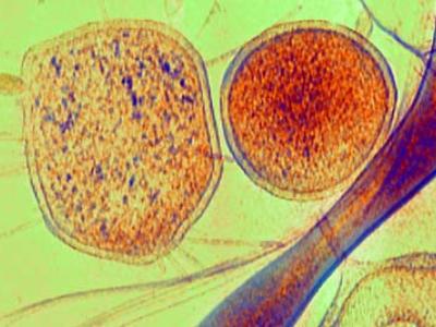 tiny cells with tiny CRISPR systems