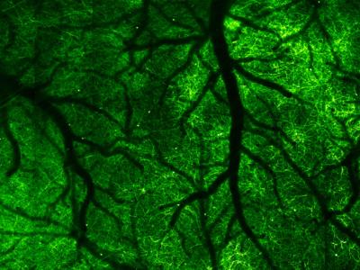 nerve cells in the brain