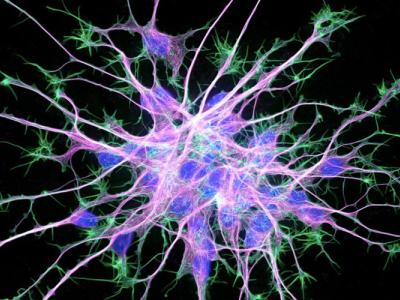 cytoskeleton of neuron