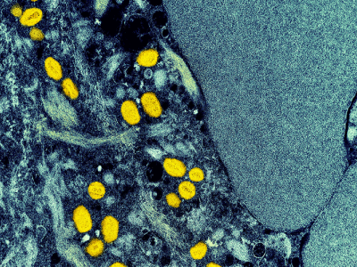 A microscope images shows small monkeypox virus particles in yellow, embedded within blue-tinted cellular tissue.