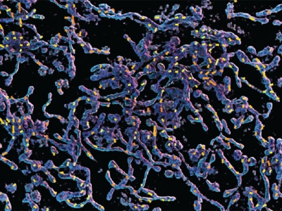 The 3D rendering of mitochondria overlaid by the motion map. The 3D volume was captured by a 3D SIM microscope in the Biological Imaging Facility and reconstructed by NSTM using the compute cluster from the Advanced Bioimaging Center.