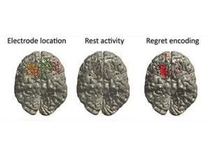 Images of brain noting electrode location, rest activity, and regret encoding.