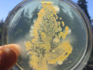 Petri Dish with microbes