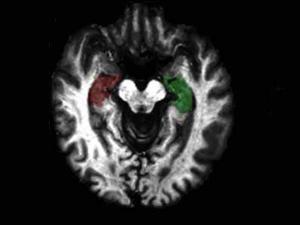 black and white images of brain