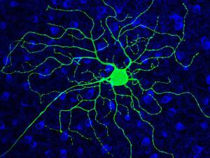 a green ganglion cell stands out agains a sea of blue retinal cells