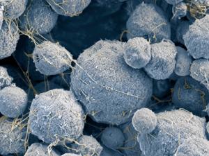 a jumble of gray blobs are archaea