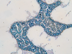 Saccharomyces cerevisiae, also known as brewer’s yeast, has been dyed blue to be seen under a microscope. 