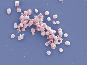 a cluster of round, pink blobs against a sky-blue background