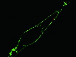 microscopic filter of single cell