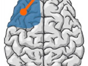 brain graphic with blue region and arrow pointing top and right