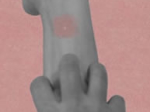 An illustration of hands scratching an itch.